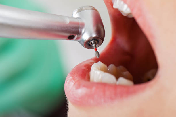 Best Root Canal Emergency Dentist  in Waxhaw, NC
